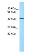 TOR1AIP2 Antibody - TOR1AIP2 antibody Western Blot of Fetal Lung.  This image was taken for the unconjugated form of this product. Other forms have not been tested.