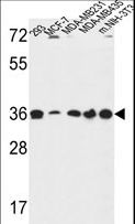 TOR1B / Torsin B Antibody - TOR1B Antibody western blot of 293,MCF-7,MDA-MB231,MDA-MB435,and mouse NIH-3T3 cell line lysates (35 ug/lane). The TOR1B antibody detected the TOR1B protein (arrow).