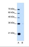 TOR1B / Torsin B Antibody - Lane A: Marker. Lane B: HepG2 cell lysate. Antibody concentration: 5.0 ug/ml. Gel concentration: 12%.  This image was taken for the unconjugated form of this product. Other forms have not been tested.