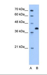 TOR2A Antibody - Lane A: Marker. Lane B: HepG2 cell lysate. Antibody concentration: 1.25 ug/ml. Gel concentration: 12%.  This image was taken for the unconjugated form of this product. Other forms have not been tested.