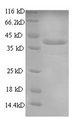 CHRNA1 Protein - (Tris-Glycine gel) Discontinuous SDS-PAGE (reduced) with 5% enrichment gel and 15% separation gel.