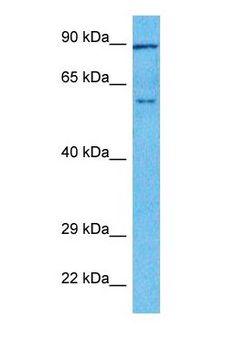 TOX Antibody - Western blot of TOX Antibody with human Ovary Tumor lysate.  This image was taken for the unconjugated form of this product. Other forms have not been tested.