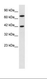 TOX2 Antibody - Jurkat Cell Lysate.  This image was taken for the unconjugated form of this product. Other forms have not been tested.
