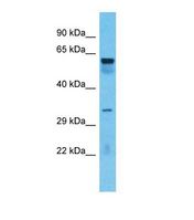 TOX4 / C14orf92 Antibody - Western blot of Human Lung tumor . TOX4 antibody dilution 1.0 ug/ml.  This image was taken for the unconjugated form of this product. Other forms have not been tested.