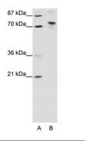 TOX4 / C14orf92 Antibody - A: Marker, B: Transfected 293T Cell Lysate.  This image was taken for the unconjugated form of this product. Other forms have not been tested.