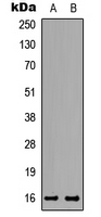 TP-2 / TNP2 Antibody - Western blot analysis of TNP2 expression in HeLa (A); PC12 (B) whole cell lysates.