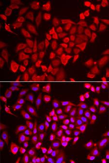 TP-2 / TNP2 Antibody - Immunofluorescence analysis of U2OS cells.