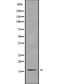 TP-2 / TNP2 Antibody - Western blot analysis of TNP2 using A549 whole cells lysates