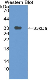 TP / Thymidine Phosphorylase Antibody - Western blot of recombinant TP / Thymidine Phosphorylase encoding amino acids 29-305.