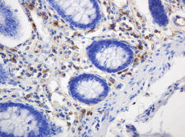 TP / Thymidine Phosphorylase Antibody - IHC of paraffin-embedded Human colon tissue using anti-TYMP mouse monoclonal antibody.