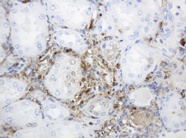TP / Thymidine Phosphorylase Antibody - IHC of paraffin-embedded Human Kidney tissue using anti-TYMP mouse monoclonal antibody. (Heat-induced epitope retrieval by 10mM citric buffer, pH6.0, 120°C for 3min).