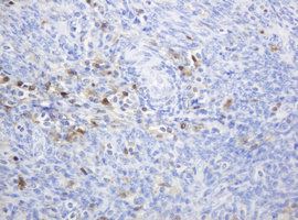 TP / Thymidine Phosphorylase Antibody - IHC of paraffin-embedded Human lymph node tissue using anti-TYMP mouse monoclonal antibody. (Heat-induced epitope retrieval by 10mM citric buffer, pH6.0, 120°C for 3min).