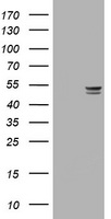 TP / Thymidine Phosphorylase Antibody - HEK293T cells were transfected with the pCMV6-ENTRY control (Left lane) or pCMV6-ENTRY TYMP (Right lane) cDNA for 48 hrs and lysed. Equivalent amounts of cell lysates (5 ug per lane) were separated by SDS-PAGE and immunoblotted with anti-TYMP.