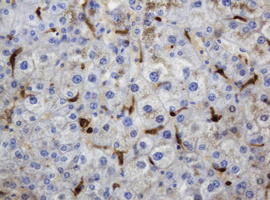 TP / Thymidine Phosphorylase Antibody - IHC of paraffin-embedded Human liver tissue using anti-TYMP mouse monoclonal antibody.