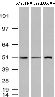 TP / Thymidine Phosphorylase Antibody - Western Blot analysis of A498, RPMI-8226 and LOX-IMVI cell lysates. (35µg) by using anti-TYMP monoclonal antibody. (Clone UMAB90)