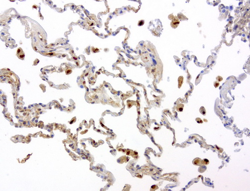 TP / Thymidine Phosphorylase Antibody - Immunohistochemical staining of paraffin-embedded human lung using anti-TYMP clone UMAB90 mouse monoclonal antibody  at 1:200 with Polink2 Broad HRP DAB detection kit; heat-induced epitope retrieval with GBI Citrate pH6.0 HIER buffer using press