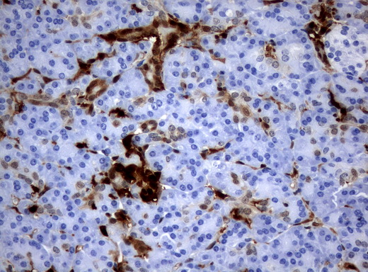 TP / Thymidine Phosphorylase Antibody - Immunohistochemical staining of paraffin-embedded Human pancreas tissue using anti-TYMP mouse monoclonal antibody.  heat-induced epitope retrieval by 10mM citric buffer, pH6.0, 120C for 3min)