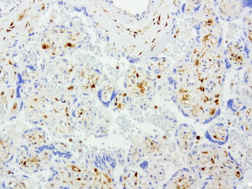 TP / Thymidine Phosphorylase Antibody - Immunohistochemical staining of paraffin-embedded human placenta using anti-TYMP clone UMAB97 mouse monoclonal antibody  at 1:200 with Polink2 Broad HRP DAB detection kit; heat-induced epitope retrieval with GBI Citrate pH6.0 HIER buffer using p