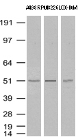 TP / Thymidine Phosphorylase Antibody - Western Blot analysis of A498, RPMI-8226 and LOX-IMVI cell lysates. (35µg) by using anti-TYMP monoclonal antibody. (Clone UMAB97)