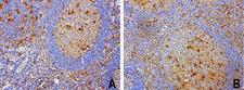 TP / Thymidine Phosphorylase Antibody - Immunohistochemical staining of paraffin-embedded human tonsil using anti-TYMP clone UMAB97 mouse monoclonal antibody  at 1:200 with Polink2 Broad HRP DAB detection kit; heat-induced epitope retrieval with GBI Citrate pH6.0 HIER buffer using pre