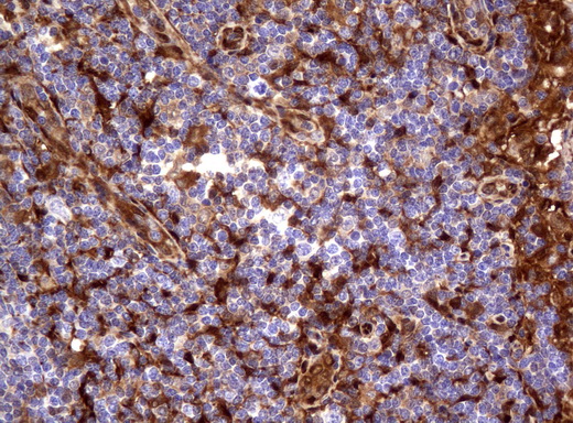 TP / Thymidine Phosphorylase Antibody - Immunohistochemical staining of paraffin-embedded Human lymph node tissue using anti-TYMP mouse monoclonal antibody.  heat-induced epitope retrieval by 10mM citric buffer, pH6.0, 120C for 3min)