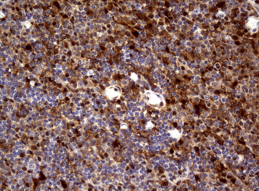 TP / Thymidine Phosphorylase Antibody - Immunohistochemical staining of paraffin-embedded Human tonsil using anti-TYMPmouse monoclonal antibody.  heat-induced epitope retrieval by 10mM citric buffer, pH6.0, 120C for 3min)