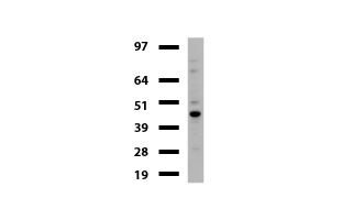 TP / Thymidine Phosphorylase Antibody - Western blot of mouse tissue lysates. (20ug) from Brain. Primary antibody diluation: 1:500. Secondary antibody dilution: Mouse TrueBlot® Ultra. (1:1000).