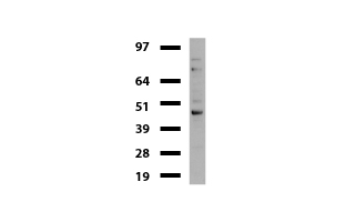 TP / Thymidine Phosphorylase Antibody - Western blot of mouse tissue lysates. (20ug) from Brain. Primary antibody diluation: 1:500. Secondary antibody dilution: Mouse TrueBlot® Ultra. (1:1000).