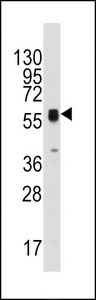 TP / Thymidine Phosphorylase Antibody - Western blot of anti-ECGF1 antibody in HepG2 cell line lysates (35 ug/lane). ECGF1(arrow) was detected using the purified antibody.