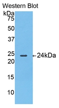 TP / Thymidine Phosphorylase Antibody - Western Blot; Sample: Recombinant protein.