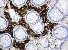 TP / Thymidine Phosphorylase Antibody - IHC of paraffin-embedded Human colon tissue using anti-TYMP mouse monoclonal antibody.