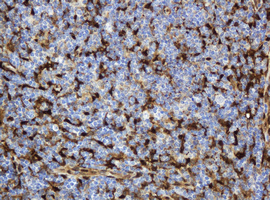 TP / Thymidine Phosphorylase Antibody - IHC of paraffin-embedded Human lymph node tissue using anti-TYMP mouse monoclonal antibody.