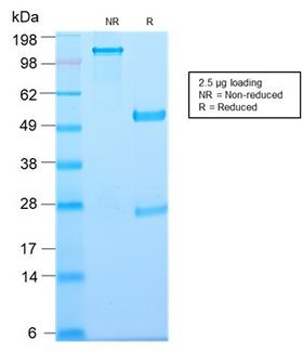 TP / Thymidine Phosphorylase Antibody - SDS-PAGE Analysis of Purified Thymidine Phosphorylase Rabbit Recombinant Monoclonal (TYMP/2890R). Confirmation of Purity and Integrity of Antibody.
