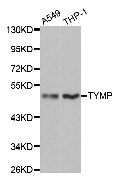 TP / Thymidine Phosphorylase Antibody - Western blot analysis of extracts of various cell lines, using TYMP antibody at 1:1000 dilution. The secondary antibody used was an HRP Goat Anti-Rabbit IgG (H+L) at 1:10000 dilution. Lysates were loaded 25ug per lane and 3% nonfat dry milk in TBST was used for blocking.