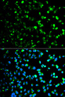 TP / Thymidine Phosphorylase Antibody - Immunofluorescence analysis of HeLa cells using TYMP antibody. Blue: DAPI for nuclear staining.