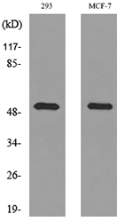TP / Thymidine Phosphorylase Antibody - Western blot analysis of lysate from 293, MCF-7 cells, using TYMP Antibody.