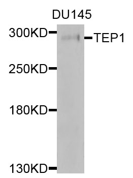 TP1 / TEP1 Antibody - Western blot analysis of extracts of TEP1 cells.