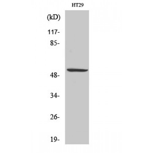TP53 / p53 Antibody - Western blot of Phospho-p53 (S15) antibody