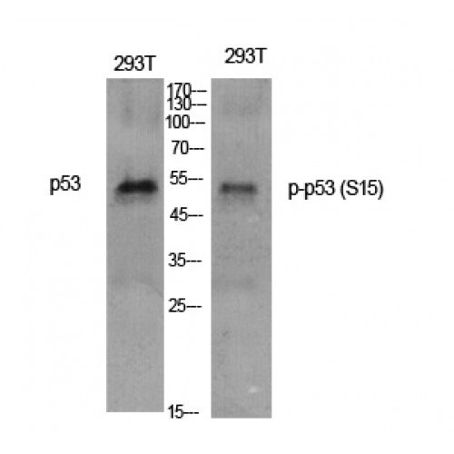 TP53 / p53 Antibody - Western blot of Phospho-p53 (S15) antibody