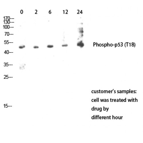 TP53 / p53 Antibody - Western blot of Phospho-p53 (T18) antibody