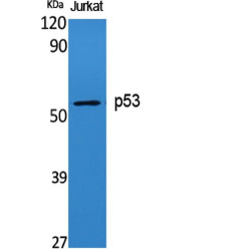 TP53 / p53 Antibody - Western blot of p53 antibody