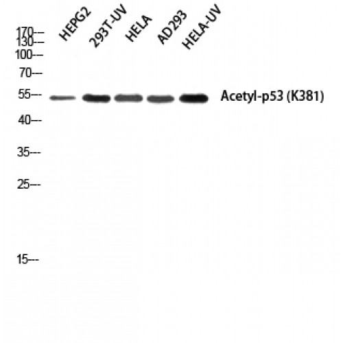TP53 / p53 Antibody - Western blot of Acetyl-p53 (K381) antibody