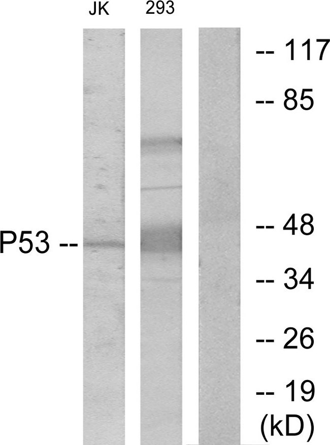 TP53 / p53 Antibody - Western blot analysis of lysates from Jurkat/293, using p53 Antibody. The lane on the right is blocked with the synthesized peptide.