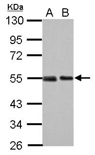 TP53 / p53 Antibody - 30ug of 293T (A) and A431 (B) cell lysates.