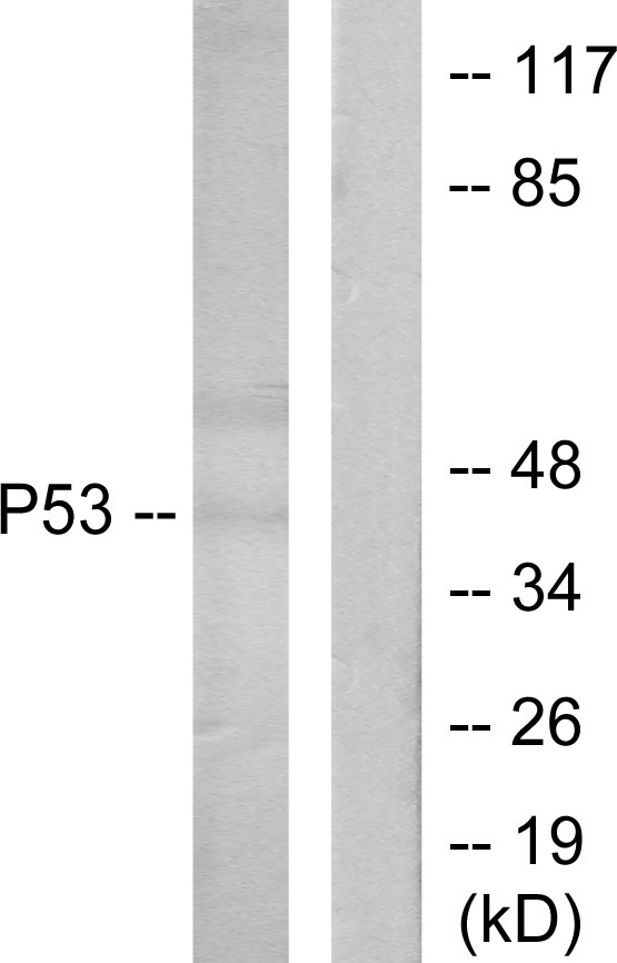 TP53 / p53 Antibody - Western blot analysis of lysates from Ovary cancer cells, using p53 Antibody. The lane on the right is blocked with the synthesized peptide.