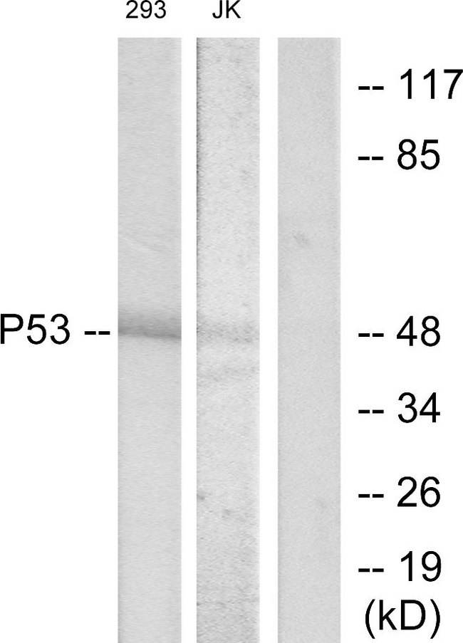 TP53 / p53 Antibody - Western blot analysis of lysates from 293 and Jurkat cells, treated with UV, using p53 Antibody. The lane on the right is blocked with the synthesized peptide.
