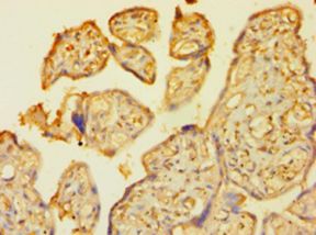 TP53 / p53 Antibody - Immunohistochemistry of paraffin-embedded human placenta using antibody at 1:100 dilution..  This image was taken for the unconjugated form of this product. Other forms have not been tested.