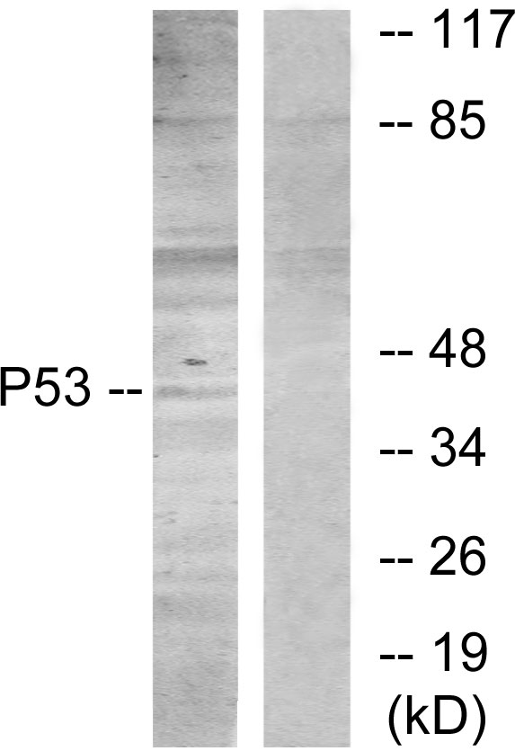 TP53 / p53 Antibody - Western blot analysis of lysates from HT29 cells, using p53 Antibody. The lane on the right is blocked with the synthesized peptide.