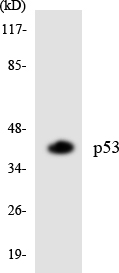 TP53 / p53 Antibody - Western blot analysis of the lysates from HUVECcells using p53 antibody.