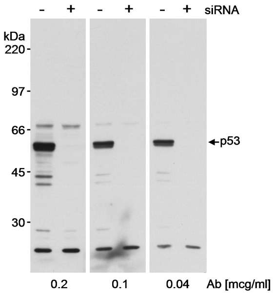 TP53 / p53 Antibody - Detection of Human p53 by Western Blot. Samples: Whole cell lysate (100 ug) from 293T cells that were treated with an siRNA for p53 (+) or mock treated (-). Antibody: Rabbit anti-p53 antibody used at the indicated concentrations. Detection: Chemiluminescence with an exposure time of less than 1 minute.
